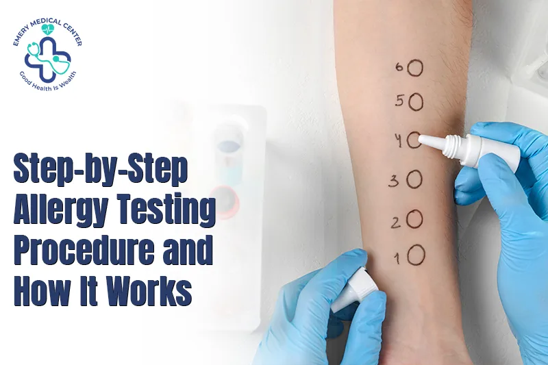 Step-by-Step Allergy Testing Procedure and How It Works