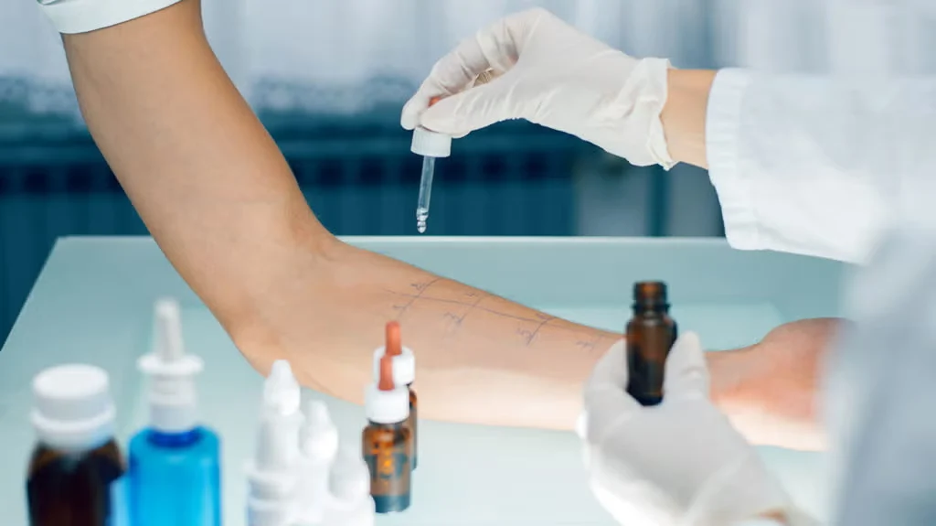 Step-by-Step Allergy Testing Procedure and How It Works
